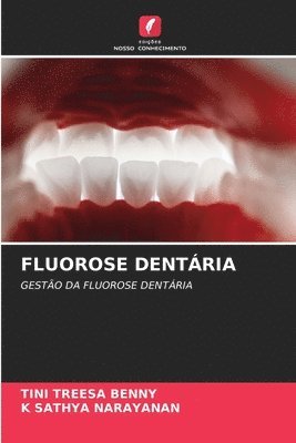 bokomslag Fluorose Dentária