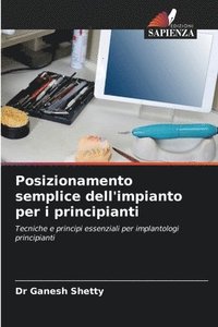 bokomslag Posizionamento semplice dell'impianto per i principianti