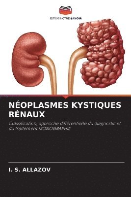 I S Allazov, I. S. Allazov, I. S. ALLAZOV - Néoplasmes Kystiques Rénaux, Häftad