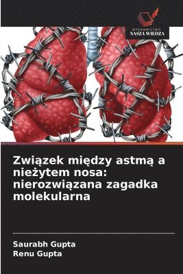 bokomslag Zwi?zek mi?dzy astm? a nie?ytem nosa: nierozwi?zana zagadka molekularna