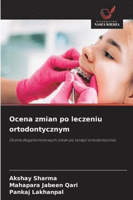 Akshay Sharma, Mahapara Jabeen Qari, Pankaj Lakhanpal - Ocena zmian po leczeniu ortodontycznym, Häftad