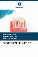 bokomslag OSSEODENSIFIKATION