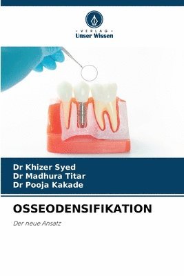 Khizer Syed, Madhura Titar, Dr Khizer Syed, Dr Madhura Titar, Pooja Kakade - Osseodensifikation, Häftad