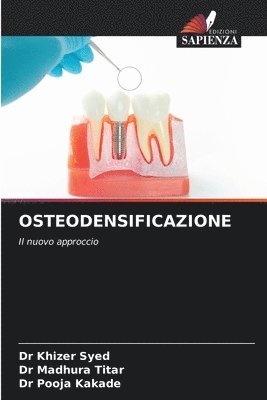 Khizer Syed, Madhura Titar, Pooja Kakade, Dr Khizer Syed, Dr Madhura Titar - Osteodensificazione, Häftad