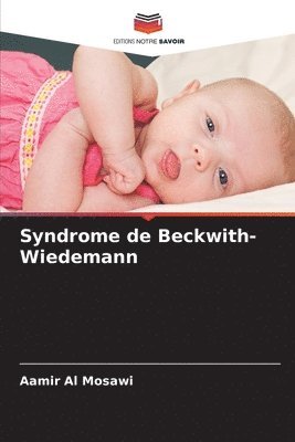 Aamir Al Mosawi - Syndrome de Beckwith-Wiedemann, Häftad