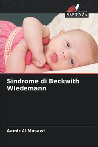 bokomslag Sindrome di Beckwith Wiedemann