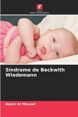 Aamir Al Mosawi - Síndrome de Beckwith Wiedemann, Häftad