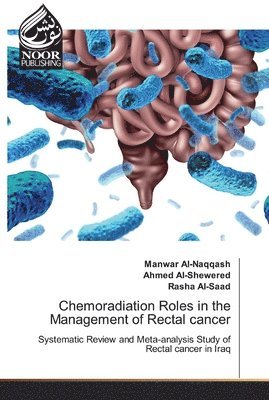 bokomslag Chemoradiation Roles in the Management of Rectal cancer