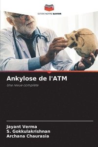 bokomslag Ankylose de l'ATM