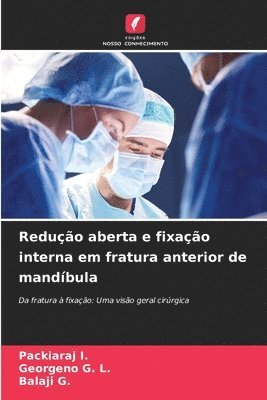 bokomslag Redução aberta e fixação interna em fratura anterior de mandíbula