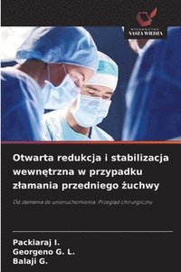 bokomslag Otwarta redukcja i stabilizacja wewn?trzna w przypadku zlamania przedniego ?uchwy