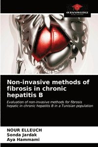 bokomslag Non-invasive methods of fibrosis in chronic hepatitis B