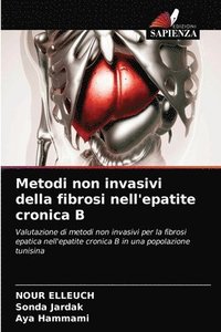 bokomslag Metodi non invasivi della fibrosi nell'epatite cronica B