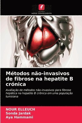 Mtodos no-invasivos de fibrose na hepatite B crnica 1