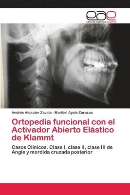 Ortopedia funcional con el Activador Abierto Elstico de Klammt 1