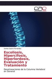 bokomslag Escoliosis, Hipercifosis, Hiperlordosis, Evaluacin y Tratamiento