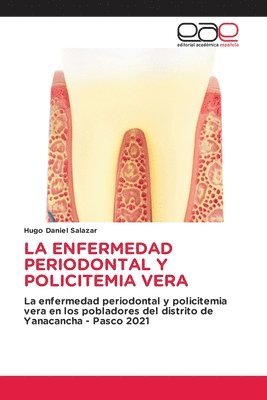 bokomslag La Enfermedad Periodontal Y Policitemia Vera