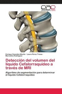 bokomslag Deteccin del volumen del lquido Cefalorraqudeo a travs de MRI