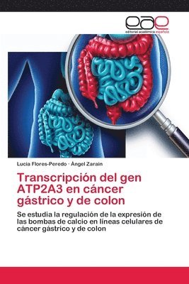 Transcripcin del gen ATP2A3 en cncer gstrico y de colon 1