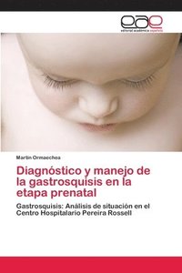 bokomslag Diagnstico y manejo de la gastrosquisis en la etapa prenatal