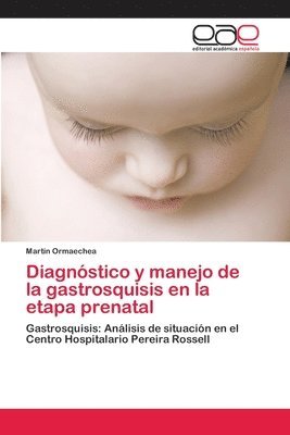 Diagnstico y manejo de la gastrosquisis en la etapa prenatal 1