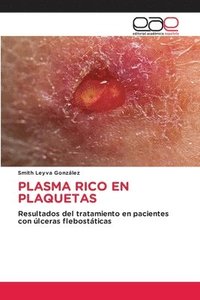 bokomslag Plasma Rico En Plaquetas