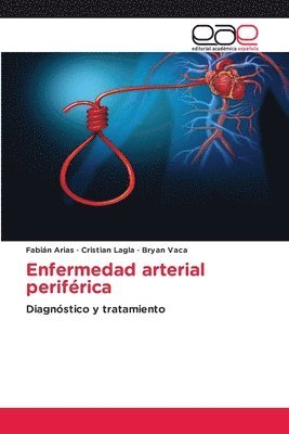 Enfermedad arterial perifrica 1