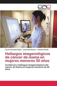 bokomslag Hallazgos imagenolgicos de cncer de mama en mujeres menores 50 aos