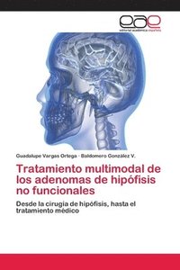 bokomslag Tratamiento multimodal de los adenomas de hipfisis no funcionales