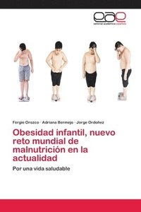 bokomslag Obesidad infantil, nuevo reto mundial de malnutricion en la actualidad