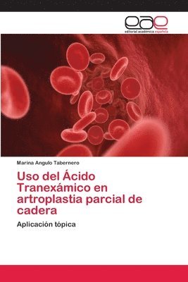 Uso del Acido Tranexamico en artroplastia parcial de cadera 1