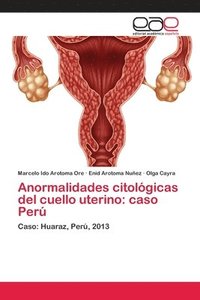 bokomslag Anormalidades citolgicas del cuello uterino