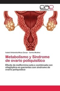 bokomslag Metabolismo y Sindrome de ovario poliquisitico