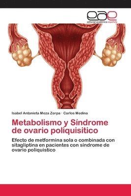 bokomslag Metabolismo y Síndrome de ovario poliquisitico