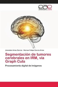 bokomslag Segmentacin de tumores cerebrales en IRM, va Graph Cuts