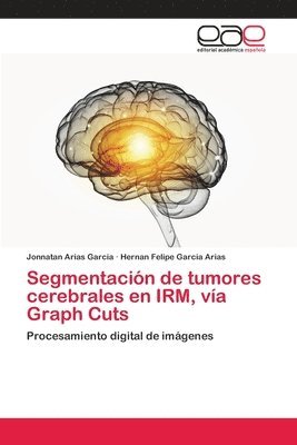 Segmentacin de tumores cerebrales en IRM, va Graph Cuts 1