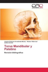 bokomslag Torus Mandibular y Palatino