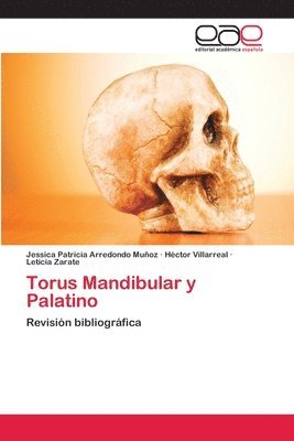 Torus Mandibular y Palatino 1