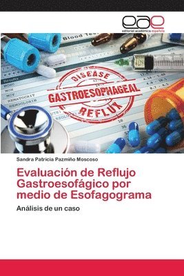 bokomslag Evaluacin de Reflujo Gastroesofgico por medio de Esofagograma