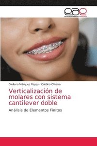 bokomslag Verticalizacion de molares con sistema cantilever doble