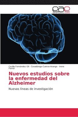 Nuevos estudios sobre la enfermedad del Alzheimer 1