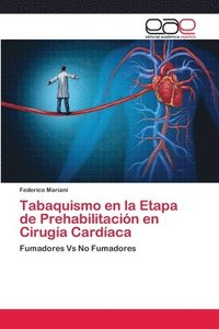 bokomslag Tabaquismo en la Etapa de Prehabilitacion en Cirugia Cardiaca