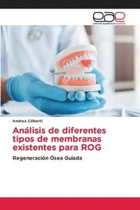 bokomslag Anlisis de diferentes tipos de membranas existentes para ROG