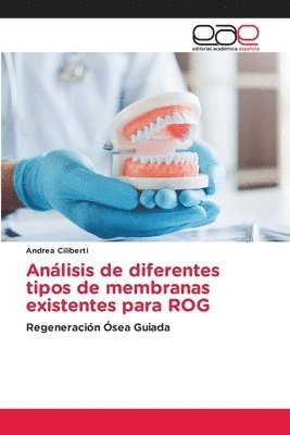 bokomslag Anlisis de diferentes tipos de membranas existentes para ROG