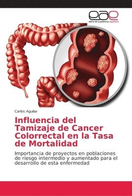 Influencia del Tamizaje de Cancer Colorrectal en la Tasa de Mortalidad 1