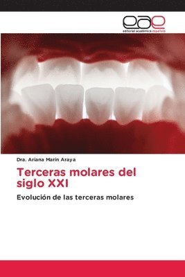 Terceras molares del siglo XXI 1