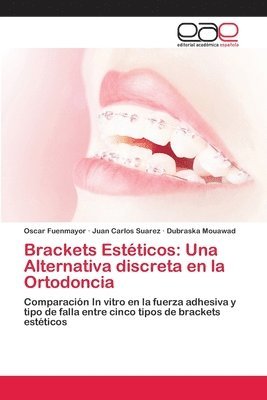 Brackets Estticos 1