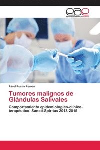 bokomslag Tumores malignos de Glandulas Salivales
