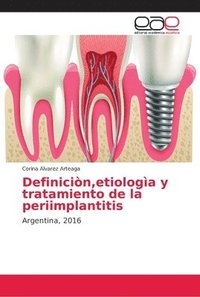 bokomslag Definicin, etiologa y tratamiento de la periimplantitis