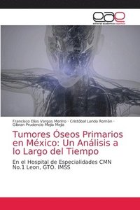 bokomslag Tumores seos Primarios en Mxico